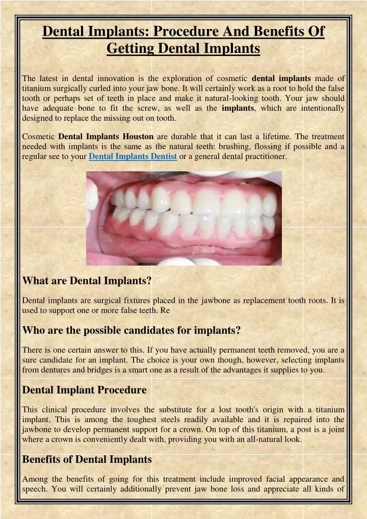 dental implants procedure and benefits of getting