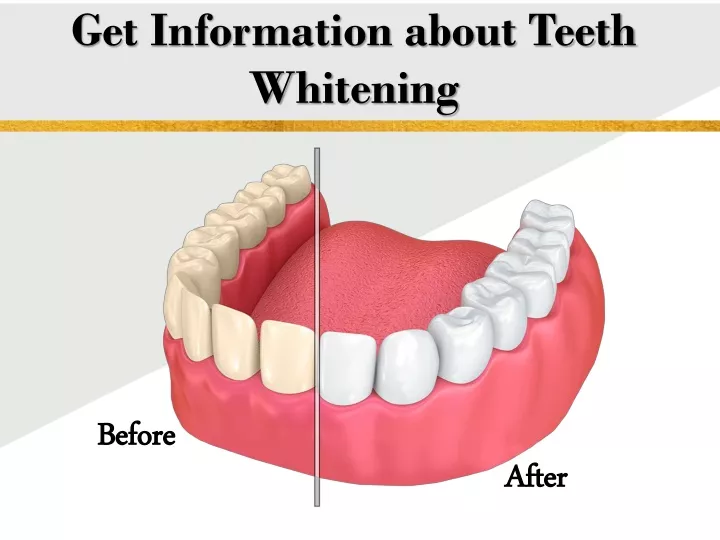 get information about teeth whitening