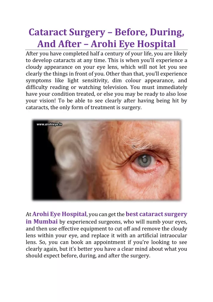 cataract surgery before during and after arohi