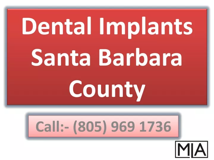 dental implants santa barbara county