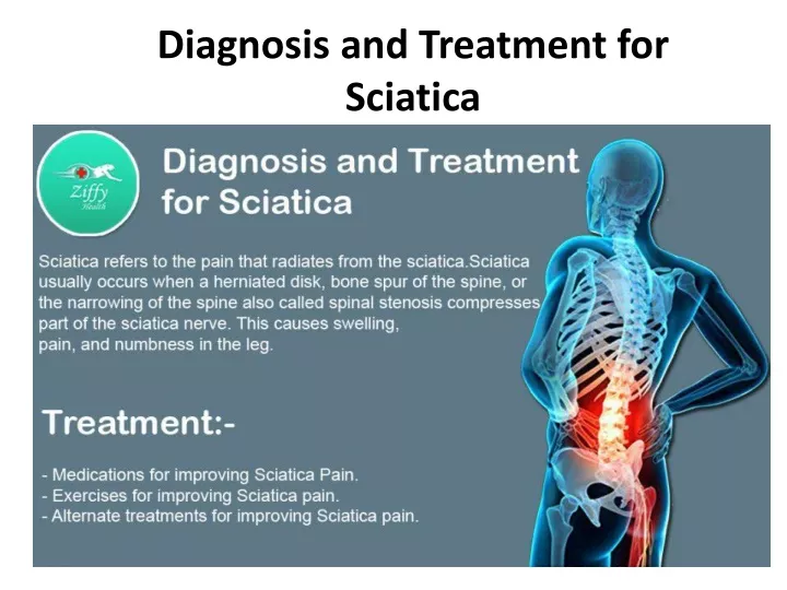 diagnosis and treatment for sciatica
