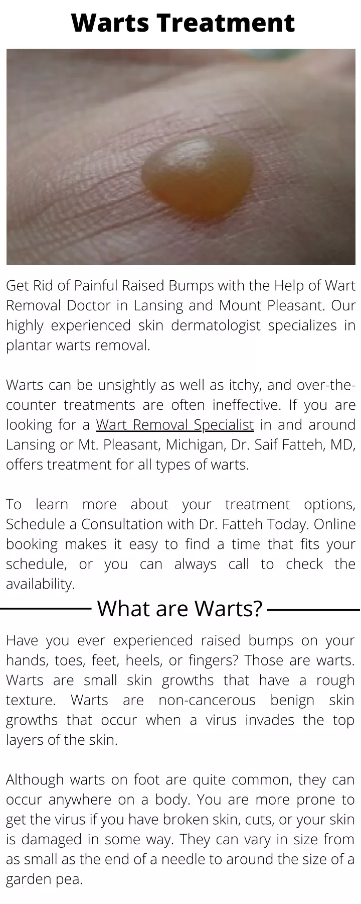 warts treatment