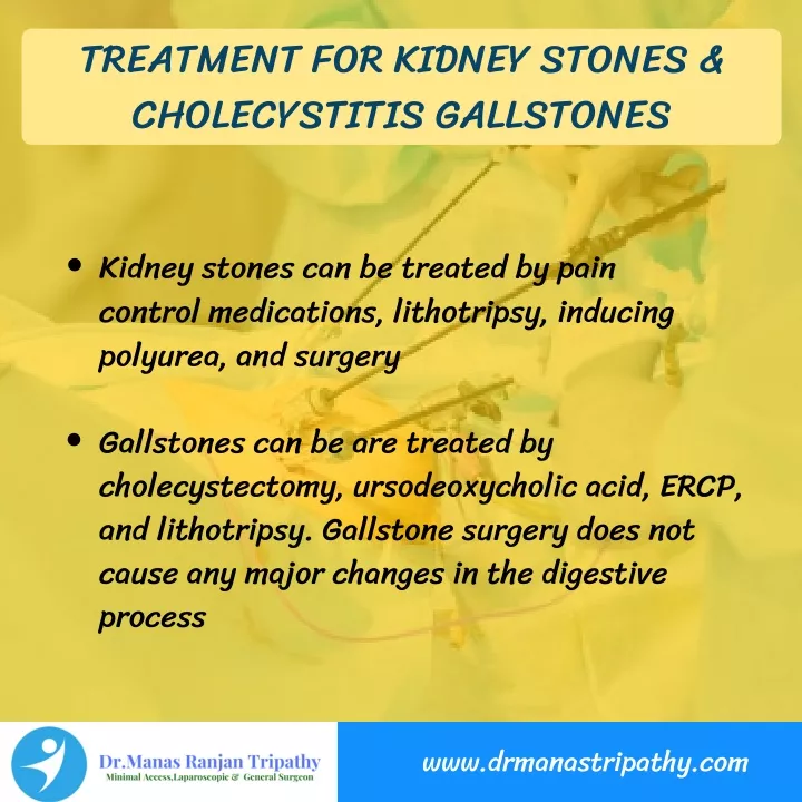 treatment for kidney stones cholecystitis