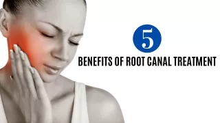 5 Benefits Of Root Canal Treatment