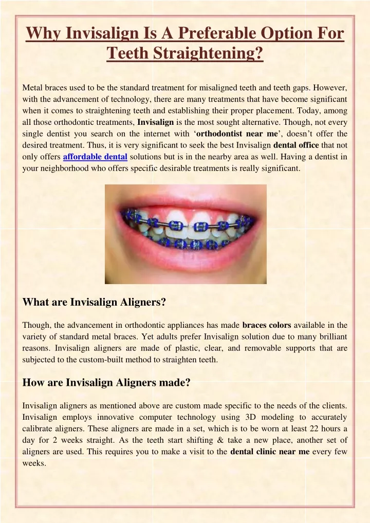 why invisalign is a preferable option for teeth