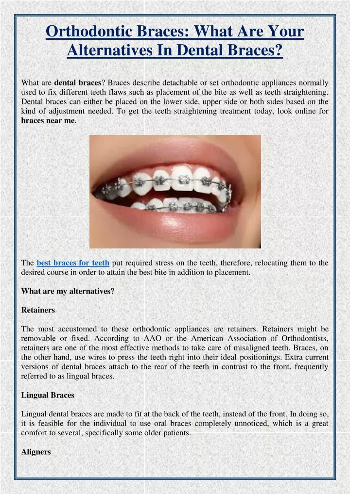 orthodontic braces what are your alternatives