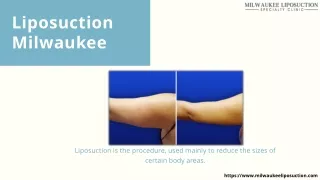 Contour your body with Milwaukee liposuction