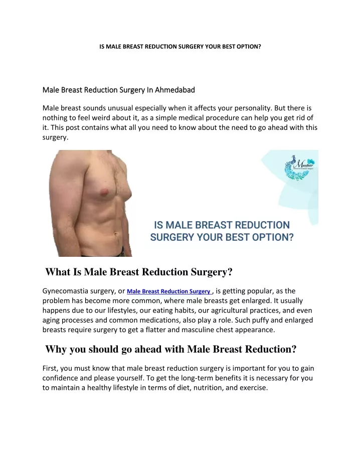 is male breast reduction surgery your best option