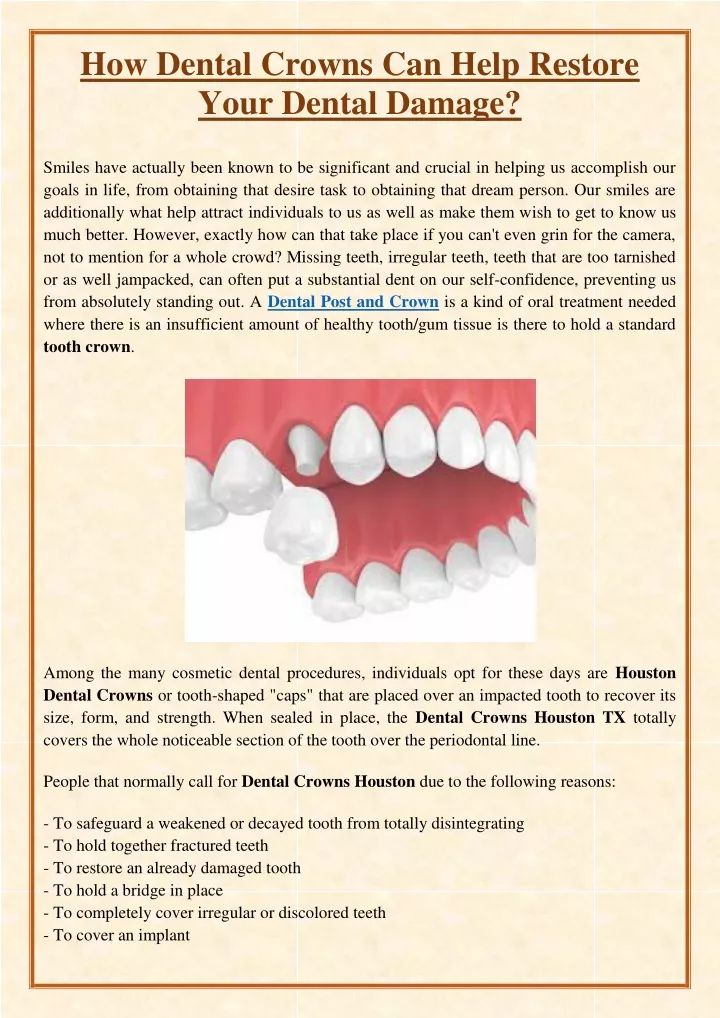 how dental crowns can help restore your dental