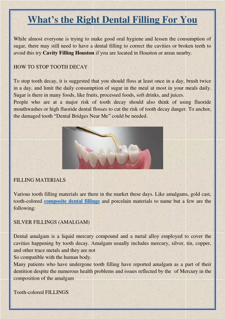 what s the right dental filling for you