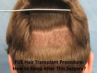 FUE Hair Transplant Procedure: How to Sleep After This Surgery?