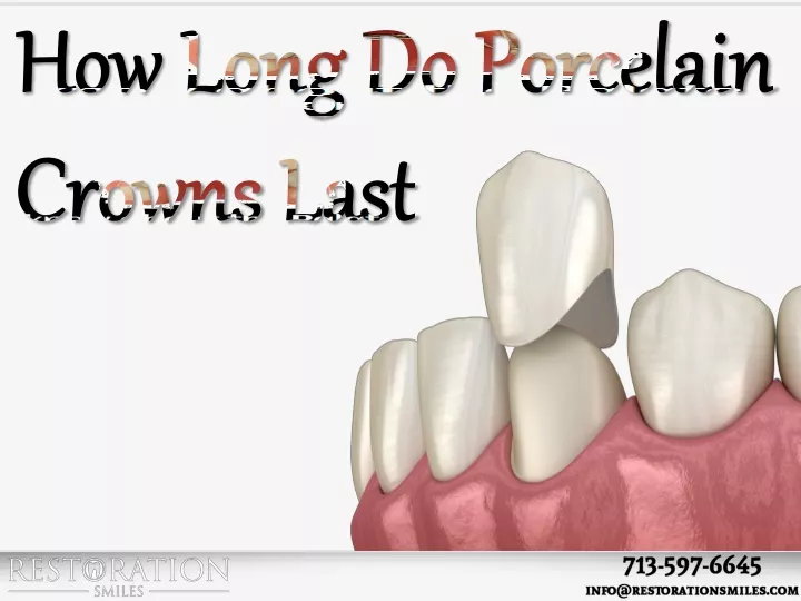 how long do porcelain crowns last