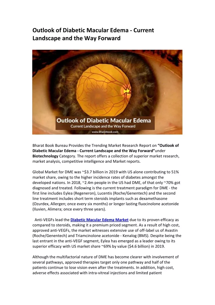outlook of diabetic macular edema current