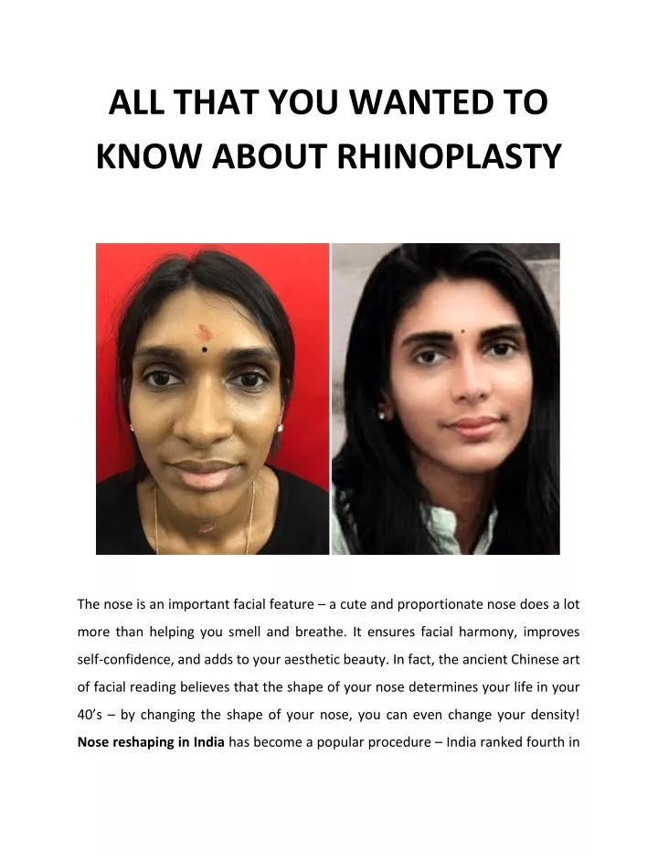 all that you wanted to know about rhinoplasty