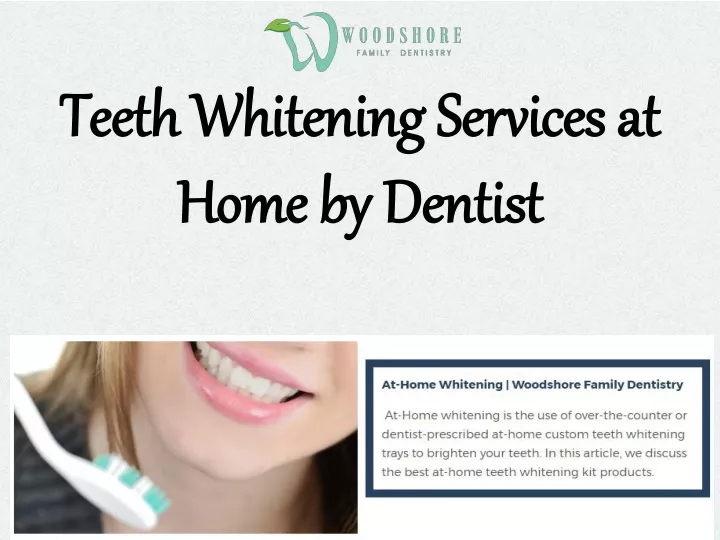 teeth whitening services at home by dentist