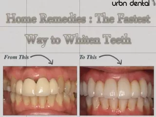 Home Remedies : The Fastest Way to Whiten Teeth
