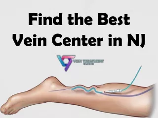 Find the Best Vein Center in NJ